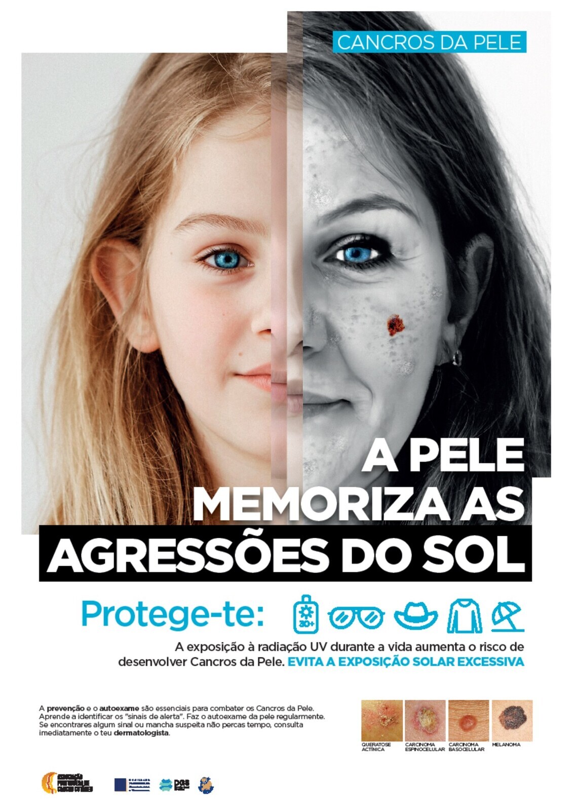 Município da Moita associa-se à Campanha "Pele e SOL Associação Portuguesa Cancro Cutâneo